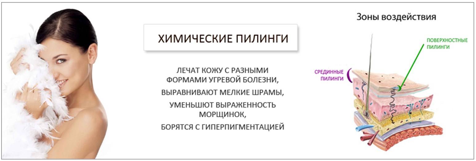 Пилинг лица: что это такое, плюсы и минусы процедуры (фото до и после)