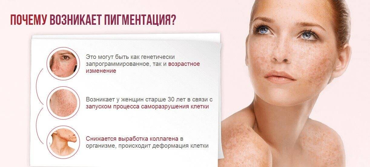 Всё о пятнах на ногах