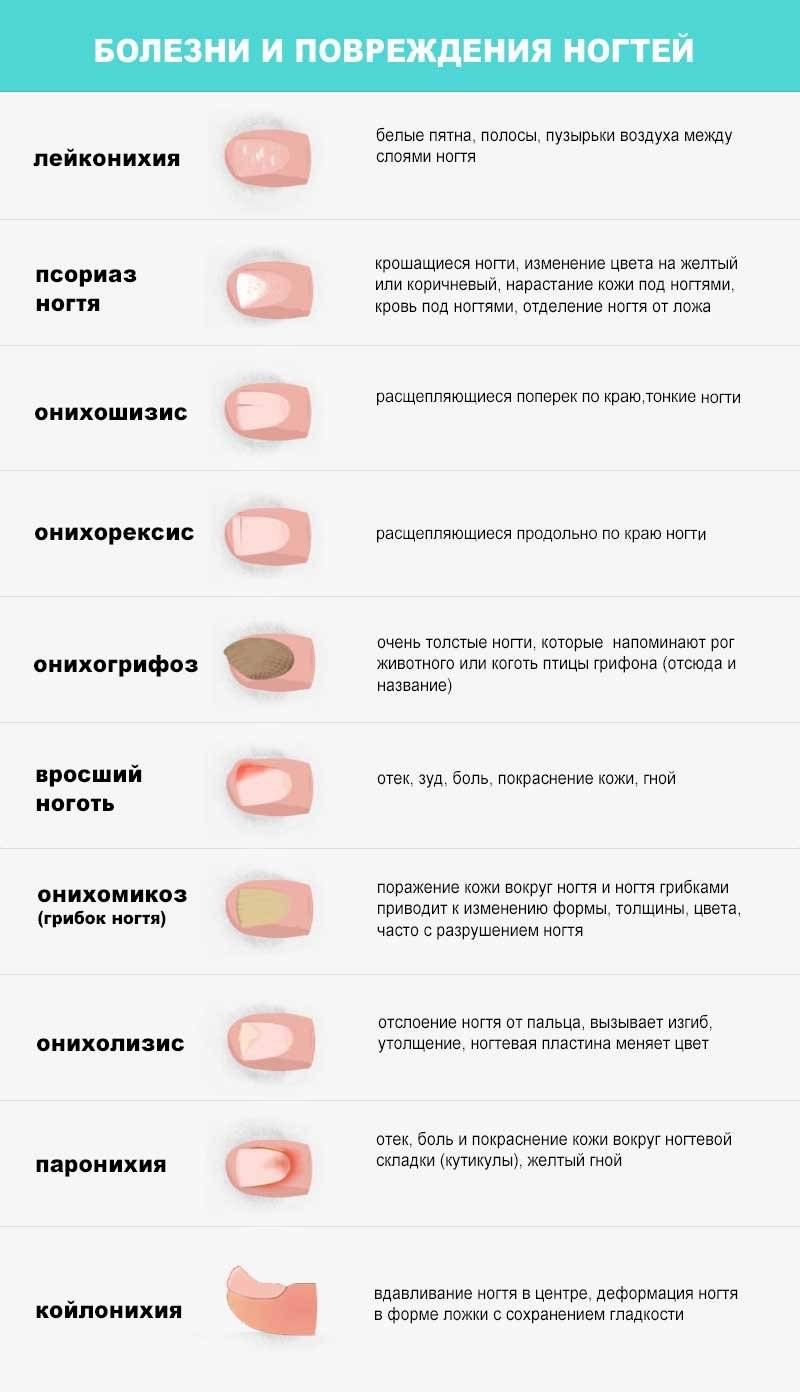 Диагностика по ногтям: как определить заболевание по ногтевой пластине | университетская клиника