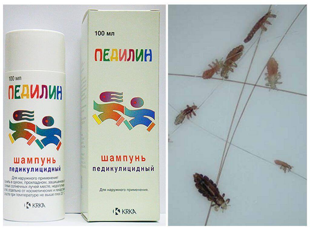 7 лучших средств от вшей в 2024 году - рейтинг mums.ru