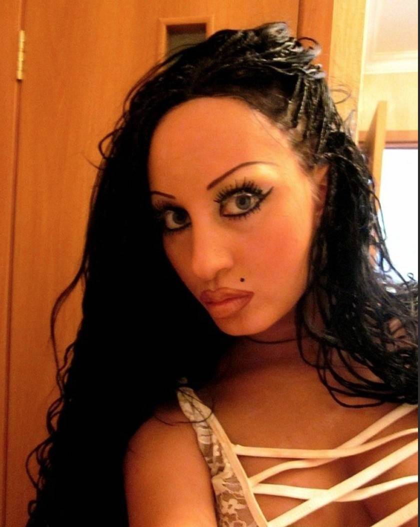 Пискун и все ее операции. биография