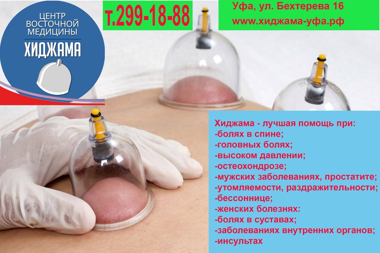 Хиджама (кровопускание, банки)
