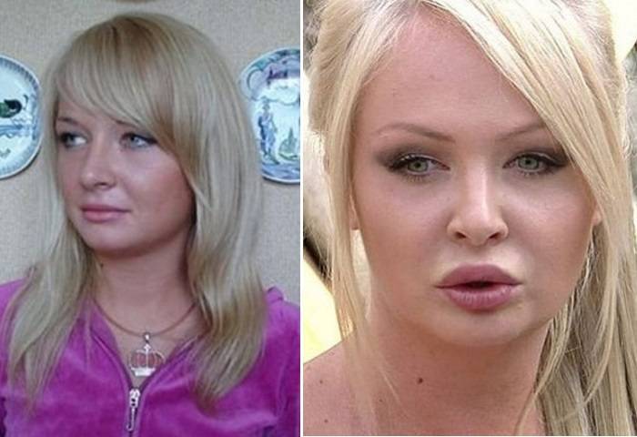 Даша пынзарь до и после пластики Дарья Пынзарь до и после пластических операций, фото и видео