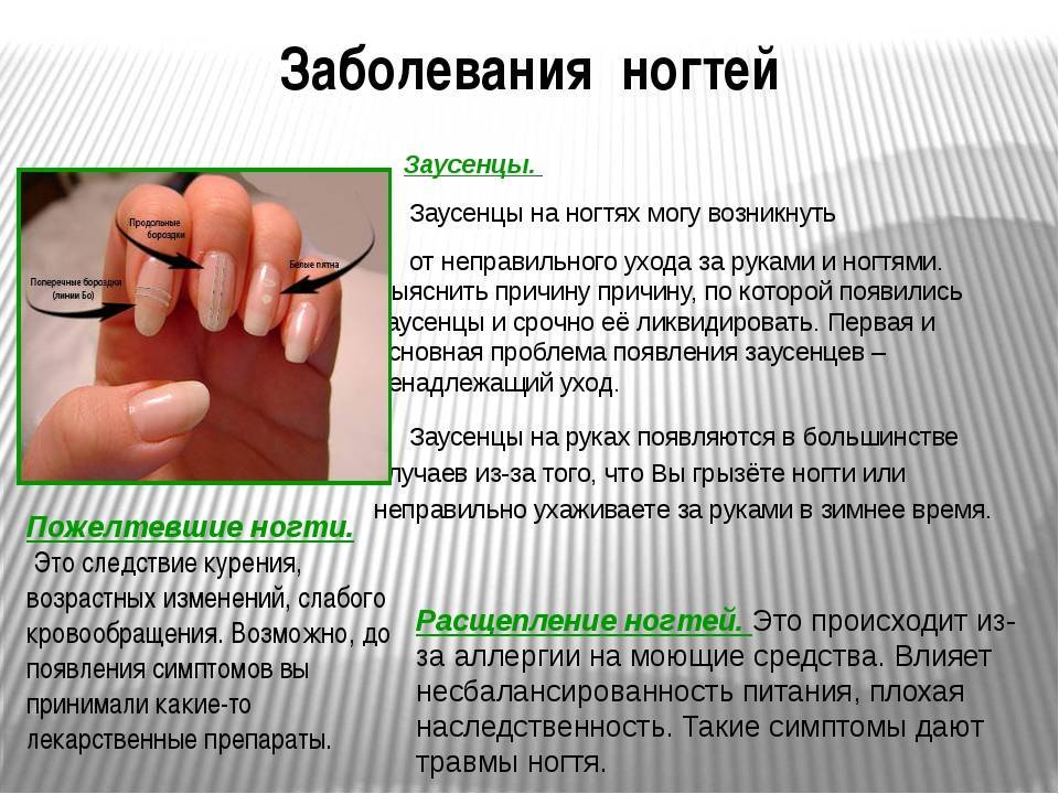 Как ухаживать за ногтями на руках: советы специалистов