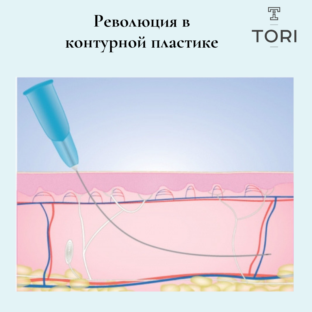 Канюли в косметологии: роль, применение, особенности