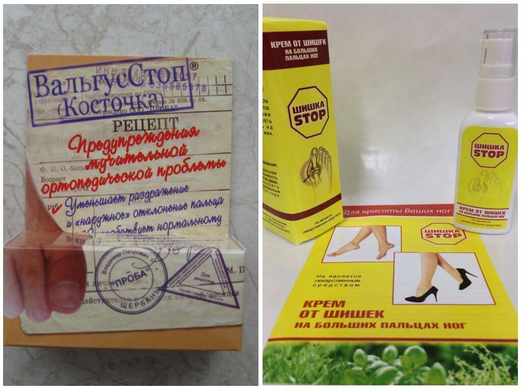 Список лучших мазей от косточки на большом пальце ноги