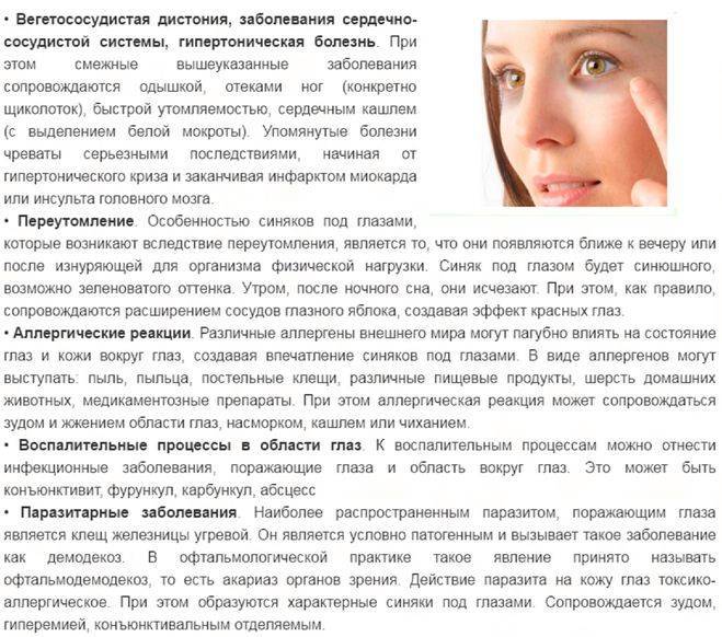 Застарелый синяк под глазом как лечить. отёк от удара под глазом: что делать, как убрать? народные методы выведения гематомы под глазом