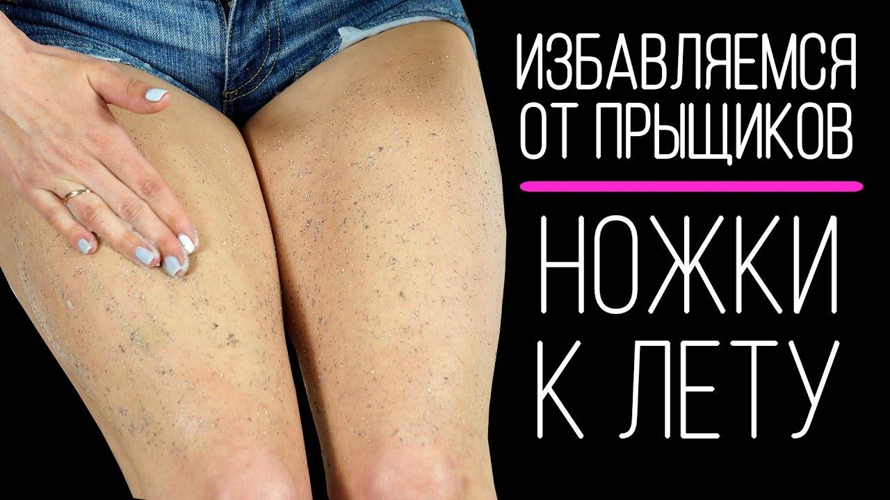 Прыщи на попе | в чем причина и как с ними бороться?