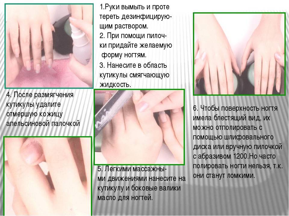 Грибок ногтей на руках: фото, как выглядит на пальцах, симптомы и признаки, нюансы лечения кожи и пластины лаком и иными средствами, и чем опасен?