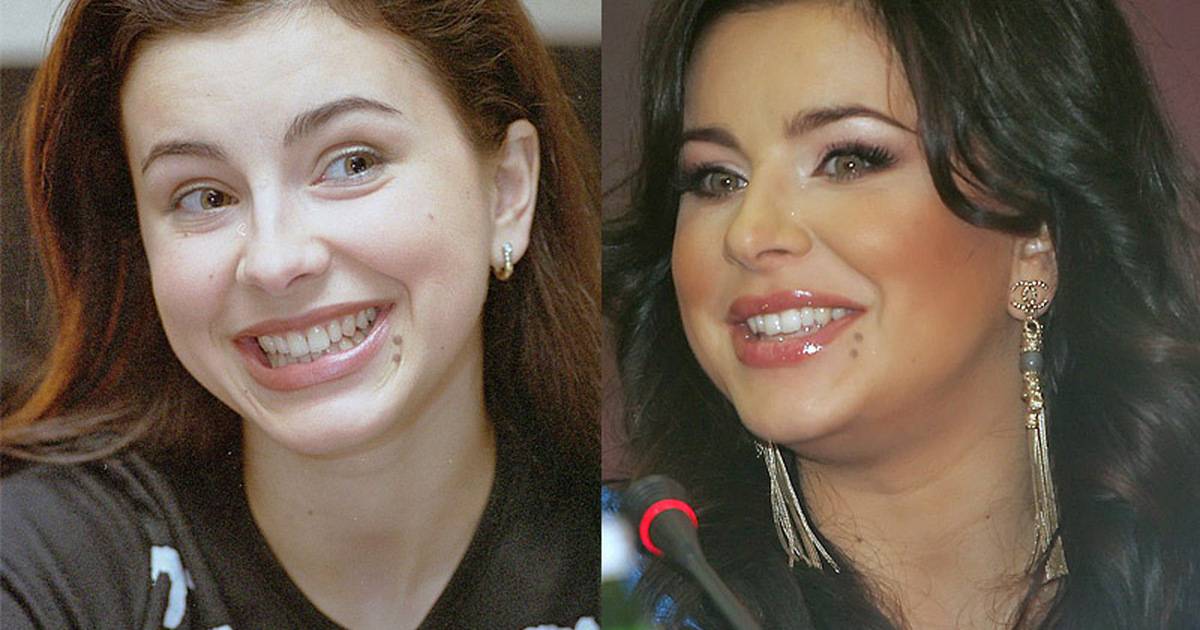 Ани лорак: пластика, делали она грудь, результат до и после для лица | marykay-4u.ru