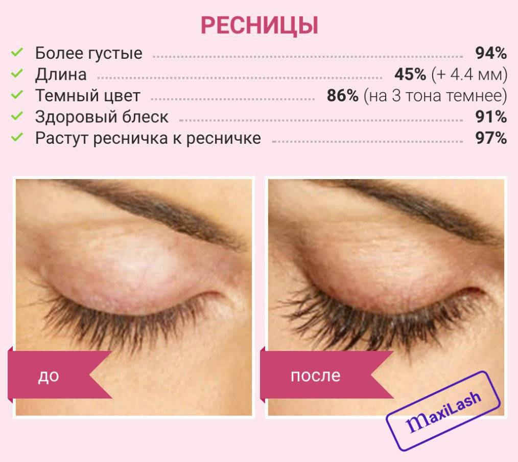 Средство для роста и укрепления ресниц: как сделать в домашних условиях / mama66.ru