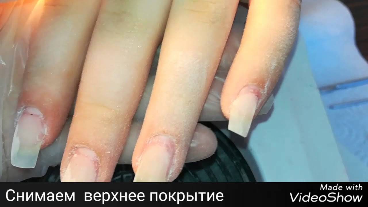 Этапы проведения коррекции гелевых ногтей