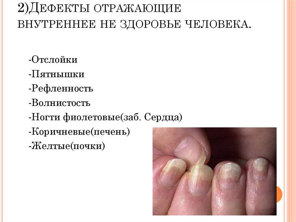 Самые распространенные болезни ногтей: справочная информация