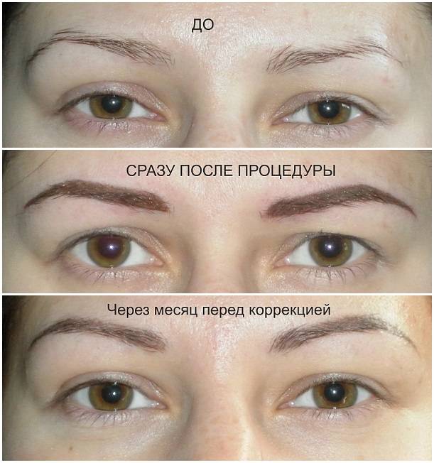Кому бровей — 12 эффективных рецептов отращивания перещипанных бровей в домашних условиях