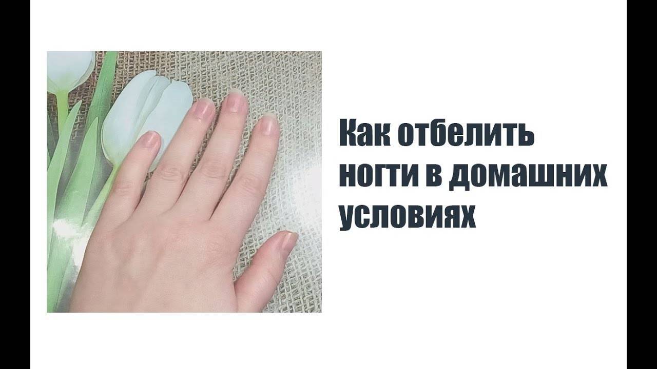 Как отбелить ногти в домашних условиях быстро - лучшие методы