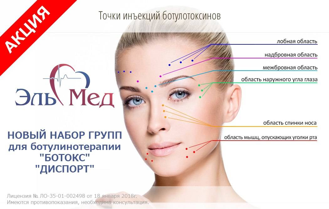 Какие бывают виды пилингов для лица в косметологии, их преимущества, способы шлифовки