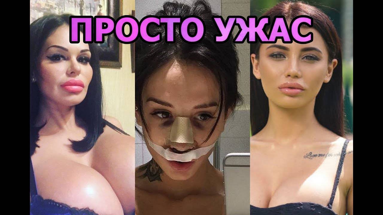 Рита керн в душе. рита керн до и после пластики (фото)