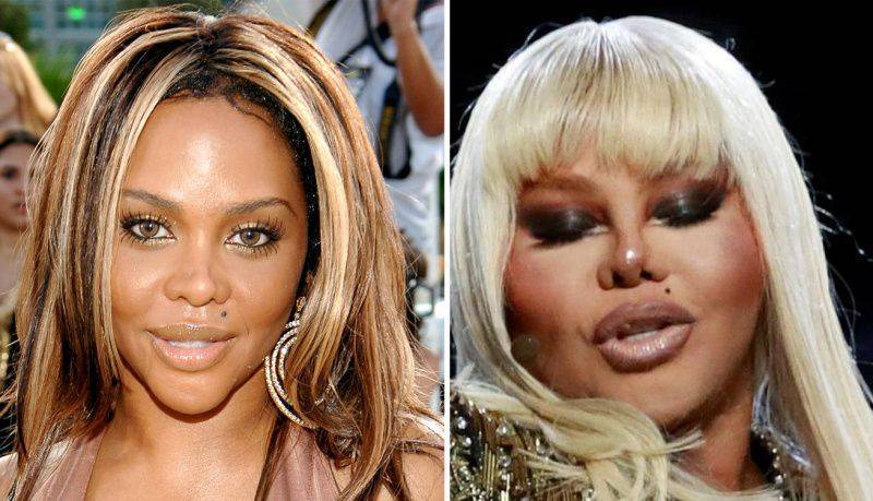 Lil kim plastic surgery 2024