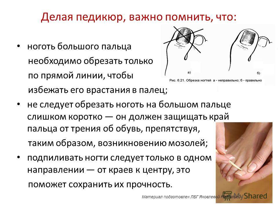 Как подстричь ногти?