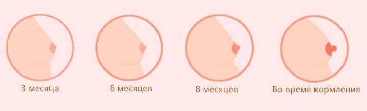 Втянутые соски