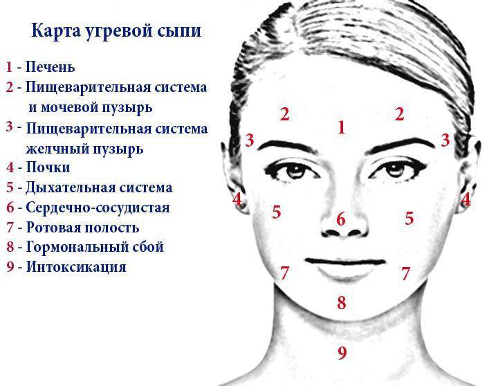 Причины появления внутренних прыщей на подбородке и их лечение - sunnyface