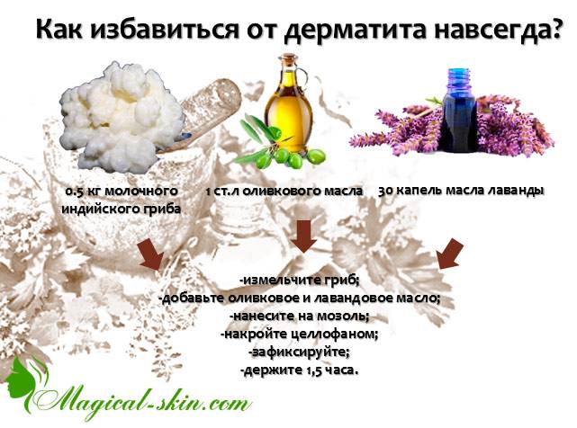 Диета при себорее кожи головы - составляем правильно
