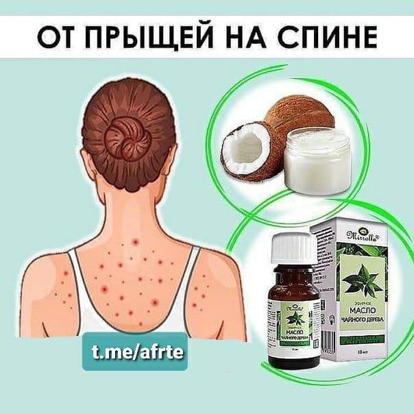 Как самостоятельно избавиться от прыщей на спине: аптечные и народные средства. советы косметолога: лечим прыщи на спине - автор екатерина данилова - журнал женское мнение