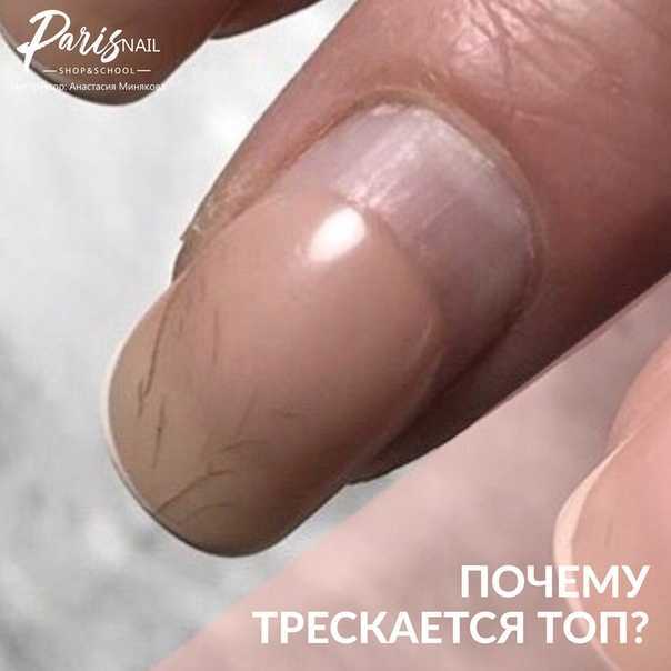 Почему отслаивается гель-лак от натуральных ногтей полностью пленкой вместе с базой и на кончиках, что делать, чтобы этого не происходило быстро, и причины отслойки