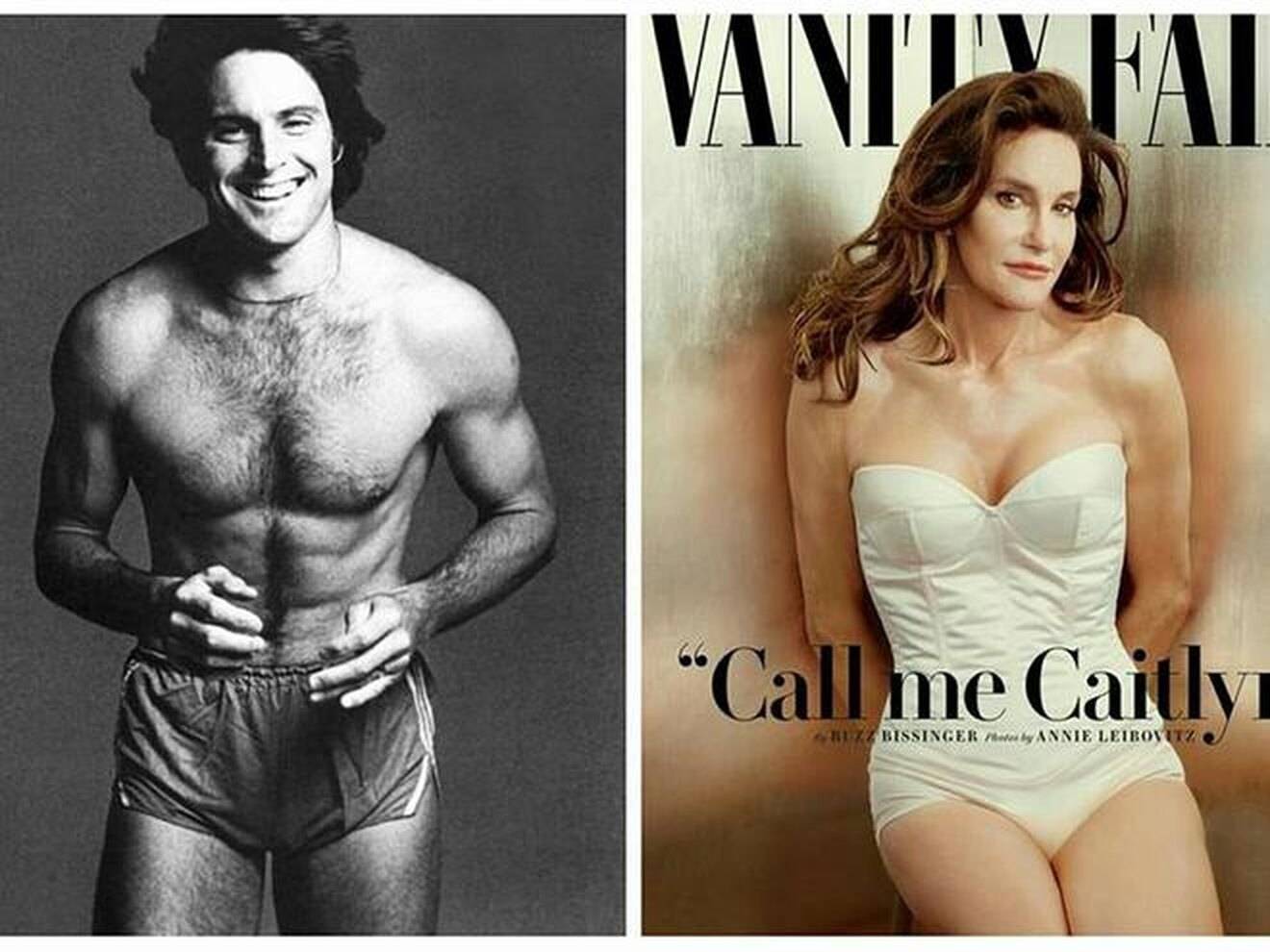 Caitlyn jenner transition surgery | women's health