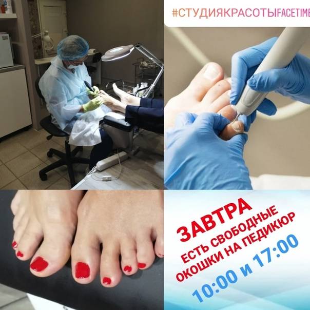 Все о медицинском педикюре