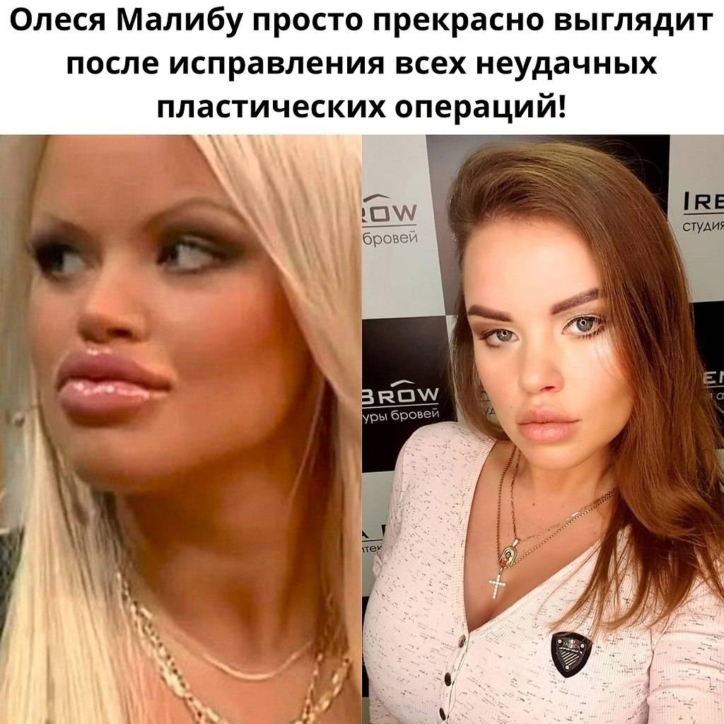 Олеся малибу: русский клон памелы андерсон - womanmirror