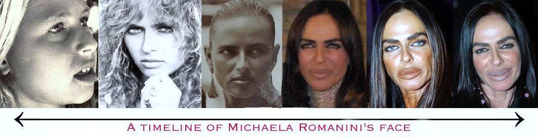 Michaela romanini plastic surgery before and after photos - latest plastic surgery gossip and news. plastic surgery tips and advice