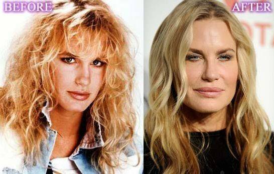 Daryl hannah plastic surgery gone wrong