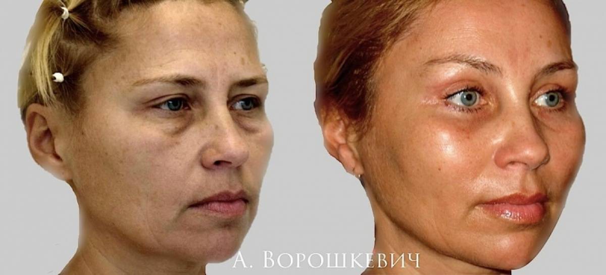 Блог