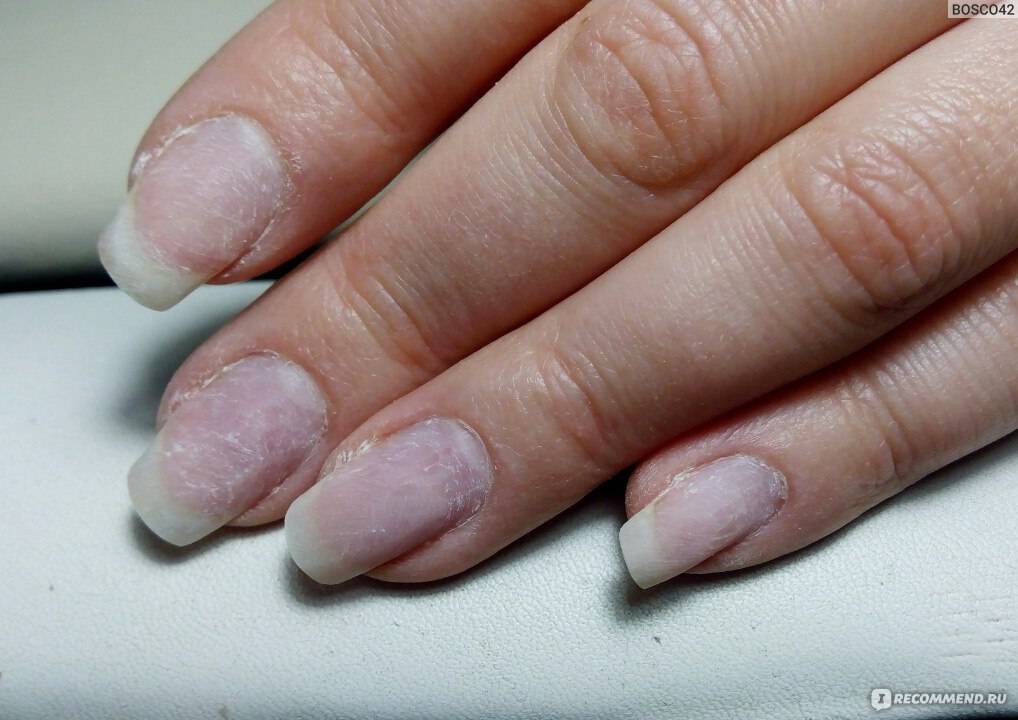 Какие плюсы и минусы имеют нарощенные ногти и как за ними ухаживать