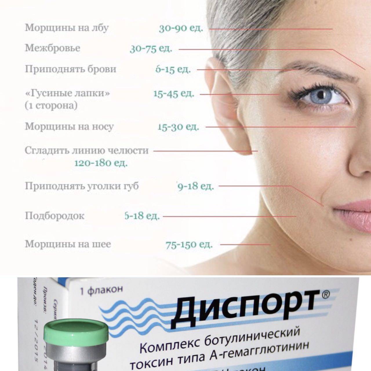 Ботокс в лоб и межбровье – что нужно знать о процедуре?