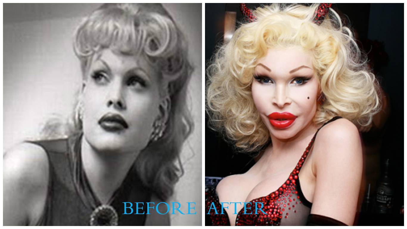 Amanda lepore до операции. аманда лепор: жизнь модели до и после операции. звездный час транса лепор