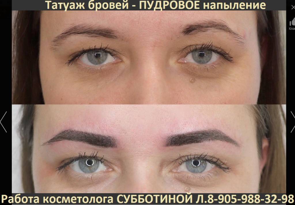 Татуаж бровей – уход после процедуры и важные советы. важные моменты в уходе за бровями после татуажа, правила и противопоказания