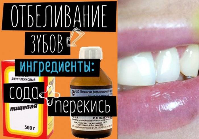Можно ли чистить зубы пищевой содой, чтобы не нанести вред эмали? 4 способа чистки