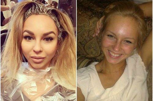 До операции анастасия лисова инстаграм. анастасия лисова: до пластики и после, фото. факты о лисовой
