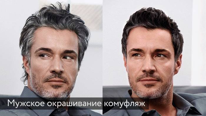 Аптечные и народные средства от седины. как избавиться от седины без окрашивания? почему седеют волосы
