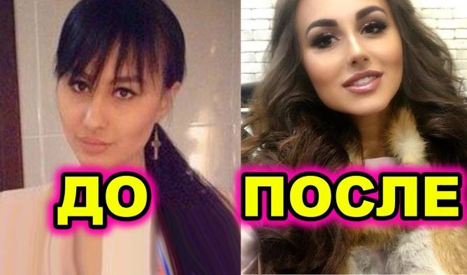 Фрост до и после пластики Лера Фрост до и после пластических операций, фото и видео