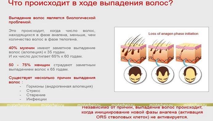 Норма выпадения волос в день у женщин