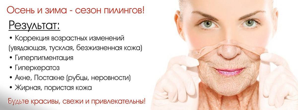 Пилинг лица: что это такое, плюсы и минусы процедуры (фото до и после)