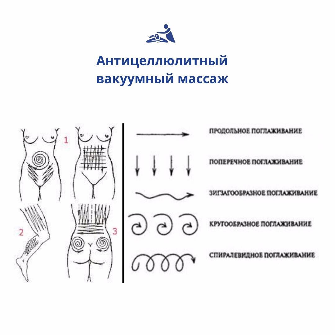 Массаж вакуумными банками в домашних условиях: боремся с лишними сантиметрами