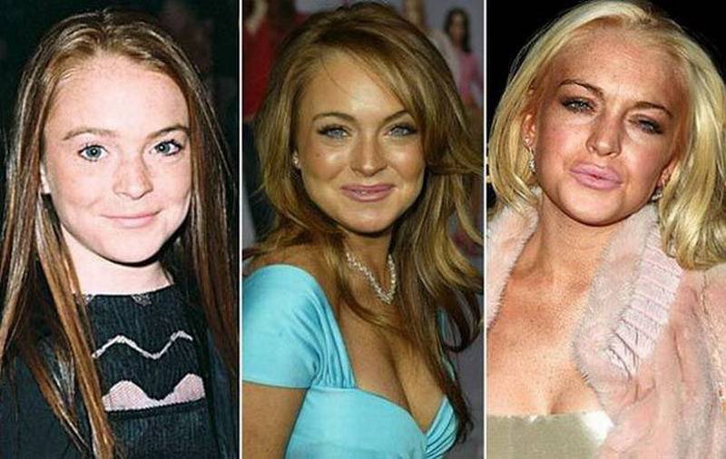 Когда пластика пошла во вред: 20 звезд, которые испортили себе лицо | simpleslim