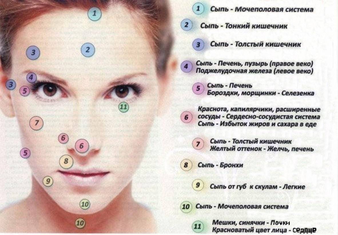 Прыщи на подбородке: от чего возникают и как от них избавиться?