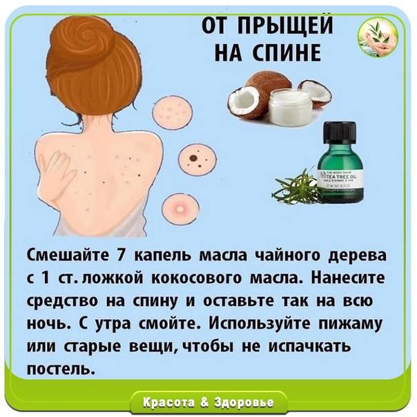 Акне на спине