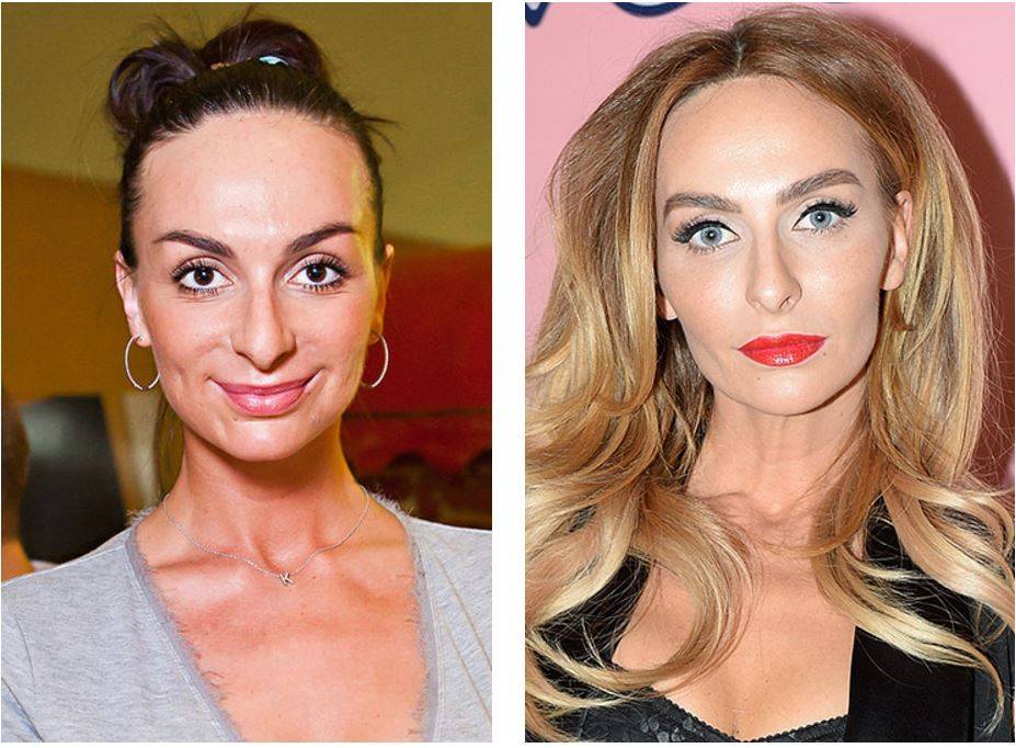 Когда пластика пошла во вред: 20 звезд, которые испортили себе лицо | simpleslim