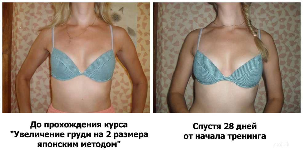 Увеличение груди с помощью йода: бабушкины сказки или правда?